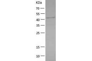 Western Blotting (WB) image for GATA Binding Protein 1 (Globin Transcription Factor 1) (GATA1) (AA 2-413) protein (His-IF2DI Tag) (ABIN7123062)