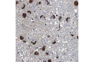 Immunohistochemical staining of human hippocampus with CYP2W1 polyclonal antibody  shows strong cytoplasmic positivity, with a granular pattern, in neuronal and glial cells. (CYP2W1 anticorps)