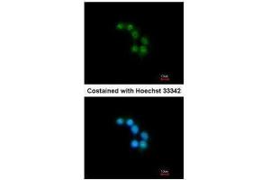 ICC/IF Image Immunofluorescence analysis of methanol-fixed HepG2, using STXBP2, antibody at 1:200 dilution. (STXBP2 anticorps)