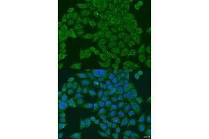 Immunofluorescence analysis of U2OS cells using PIWIL1 antibody (ABIN2564557) at dilution of 1:100.