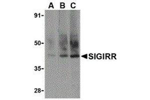 Western Blotting (WB) image for anti-Single Immunoglobulin and Toll-Interleukin 1 Receptor (TIR) Domain (SIGIRR) (C-Term) antibody (ABIN2476474) (SIGIRR anticorps  (C-Term))