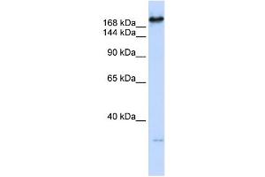 CAD antibody used at 1 ug/ml to detect target protein. (CAD anticorps  (C-Term))