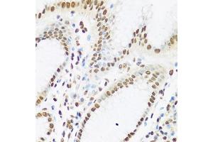 Immunohistochemistry of paraffin-embedded human stomach using Ku80 antibody (ABIN6130932, ABIN6150308, ABIN6150310 and ABIN6217336) at dilution of 1:100 (40x lens). (XRCC5 anticorps  (AA 540-732))