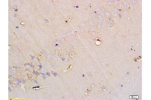 Formalin-fixed and paraffin embedded rat brain tissue labeled with Anti-SGLT1 Polyclonal Antibody, Unconjugated at 1:200 followed by conjugation to the secondary antibody and DAB staining