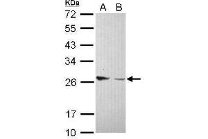 WB Image Sample (30 ug of whole cell lysate) A: IMR32 B: U87-MG 12% SDS PAGE antibody diluted at 1:1000 (Amphiregulin anticorps)