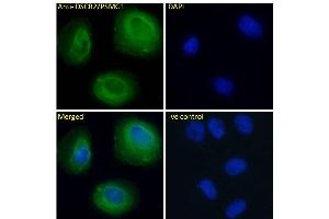 ABIN570956 Immunofluorescence analysis of paraformaldehyde fixed U2OS cells, permeabilized with 0. (PSMG1 anticorps  (C-Term))