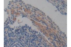 Detection of ABCA1 in Mouse Ovary Tissue using Polyclonal Antibody to ATP Binding Cassette Transporter A1 (ABCA1)