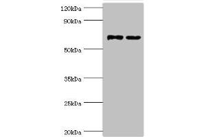 Western blot All lanes: Myotubularin-related protein 14 antibody at 10 μg/mL Lane 1: Hela whole cell lysate Lane 2: Mouse skeletal muscle tissue Secondary Goat polyclonal to rabbit IgG at 1/10000 dilution Predicted band size: 73, 67, 61 kDa Observed band size: 73 kDa (MTMR14 anticorps  (AA 1-280))