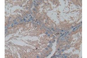 Detection of CTSL in Rat Testis Tissue using Polyclonal Antibody to Cathepsin L (CTSL)