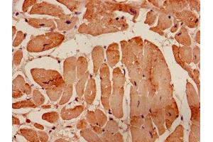 Immunohistochemistry of paraffin-embedded human heart tissue using ABIN7143128 at dilution of 1:100