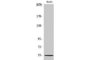 Western Blotting (WB) image for anti-Serpin Peptidase Inhibitor, Clade G (C1 Inhibitor), Member 1 (SERPING1) (Internal Region) antibody (ABIN6283318)