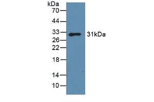 Western blot analysis of recombinant Mouse GAL3. (Galectin 3 anticorps  (AA 2-264))