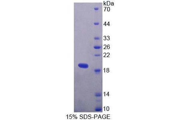 TIAM1 Protein (AA 1261-1397) (T7 tag,His tag)