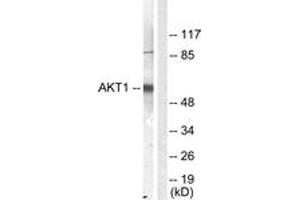 Western blot analysis of extracts from NIH-3T3 cells, treated with Serum 10% 30', using Akt (Ab-450) Antibody. (AKT1 anticorps  (AA 416-465))