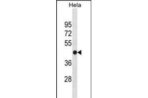 FH Antibody (N-term) (ABIN1538954 and ABIN2849886) western blot analysis in Hela cell line lysates (35 μg/lane). (FH anticorps  (N-Term))