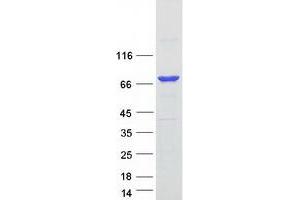 Validation with Western Blot