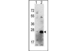 Western blot analysis of CSNK2B (arrow) using rabbit polyclonal CSNK2B Antibody (CSNK2B anticorps  (C-Term))