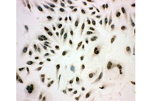 Anti-MCM3 antibody, ICC ICC: HELA Cell