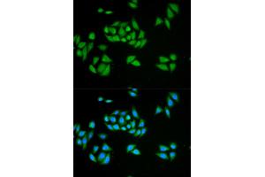 Immunofluorescence analysis of HeLa cells using UPF1 antibody. (RENT1/UPF1 anticorps)