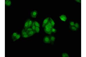 Immunofluorescence staining of HepG2 cells with ABIN7155641 at 1:133, counter-stained with DAPI. (ALX3 anticorps  (AA 11-127))