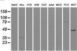 Western blot analysis of extracts (35 µg) from 9 different cell lines by using anti-CD4 monoclonal antibody. (CD4 anticorps)