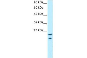 WB Suggested Anti-MYCBP Antibody Titration: 0. (MYCBP anticorps  (Middle Region))