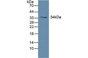 Western blot analysis of Human Lung Tissue. (Growth Hormone Receptor anticorps  (AA 315-574))