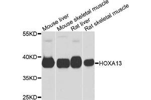 Western blot analysis of extracts of various cells, using HOXA13 antibody. (HOXA13 anticorps)