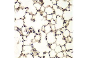 Immunohistochemistry of paraffin-embedded mouse lung using PHF11 antibody at dilution of 1:100 (x400 lens). (PHF11 anticorps)