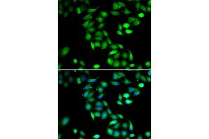 Immunofluorescence analysis of HeLa cells using PDCD6 antibody (ABIN5974030). (PDCD6 anticorps)