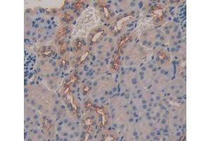 IHC-P analysis of kidney tissue, with DAB staining. (ABCC6 anticorps  (AA 1260-1498))