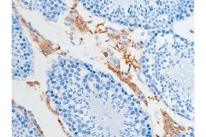 ABIN6255391 and ABIN6267252 at 1/100 staining rat testicular tissue sections by IHC-P. (CHEK2 anticorps  (pSer516))
