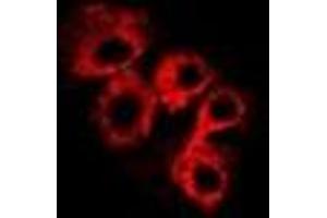Immunofluorescent analysis of C4BP beta staining in Hela cells. (C4BPB anticorps)