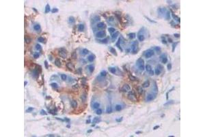 IHC-P analysis of Human Tissue, with DAB staining. (SMPD2 anticorps  (AA 2-236))