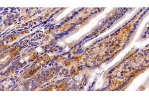 Detection of NME2 in Mouse Colon Tissue using Polyclonal Antibody to Non Metastatic Cells 2, Protein NM23B Expressed In (NME2)