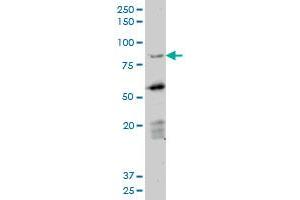 DAZ1 monoclonal antibody (M06), clone 3E3. (DAZ1 anticorps  (AA 21-120))
