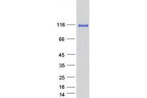 Validation with Western Blot