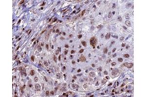 ABIN6266946 at 1/100 staining human lung tissue sections by IHC-P. (CDKL4 anticorps  (Internal Region))