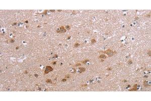 Immunohistochemistry of paraffin-embedded Human brain using PPP2R3C Polyclonal Antibody at dilution of 1:30 (PPP2R3C anticorps)