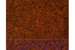 Immunofluorescence analysis of Rat liver using UGT1A1 Polyclonal Antibody at dilution of 1:100. (UGT1A1 anticorps)