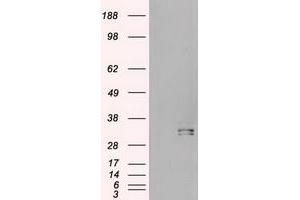 HEK293T cells were transfected with the pCMV6-ENTRY control (Left lane) or pCMV6-ENTRY HHex (RC204815) (Right lane) cDNA for 48 hrs and lysed.