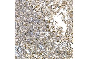 Immunohistochemistry of paraffin-embedded human tonsil using TCF1/TCF7 Rabbit mAb (ABIN7270885) at dilution of 1:100 (40x lens).