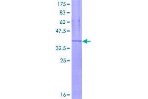 Image no. 1 for Integrin, alpha X (Complement Component 3 Receptor 4 Subunit) (ITGAX) (AA 114-223) protein (GST tag) (ABIN1308185)