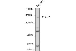 Western blot analysis of extracts of Rat brain, using Matrin 3 Rabbit mAb (ABIN7268414) at 1:1000 dilution. (MATR3 anticorps)