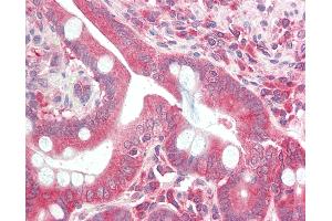 Anti-DCP2 antibody IHC staining of human small intestine.