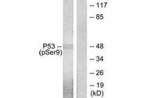 Western blot analysis of extracts from LOVO cells, using p53 (Phospho-Ser9) Antibody. (p53 anticorps  (pSer9))