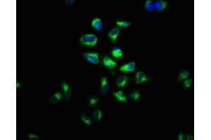 Immunofluorescence staining of Hela cells with ABIN7158126 at 1:100, counter-stained with DAPI. (LGR4 anticorps  (AA 234-365))