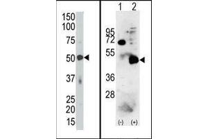 (LEFT) The PDK4 Antibody (C-term) is used in Western blot to detect PDK4 in mouse skeletal muscle tissue lysate. (PDK4 anticorps  (C-Term))