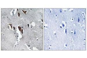 Immunohistochemistry (IHC) image for anti-ELOVL Fatty Acid Elongase 5 (ELOVL5) (C-Term) antibody (ABIN1851297) (ELOVL5 anticorps  (C-Term))