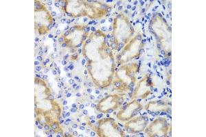 Immunohistochemistry of paraffin-embedded mouse kidney using HCLS1 antibody (ABIN3023093, ABIN3023094, ABIN3023095 and ABIN6219386) at dilution of 1:100 (40x lens).